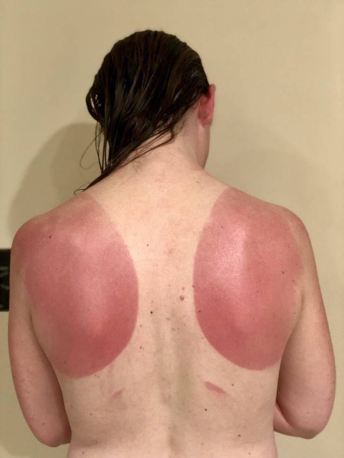 Never Forget Sunscreen!